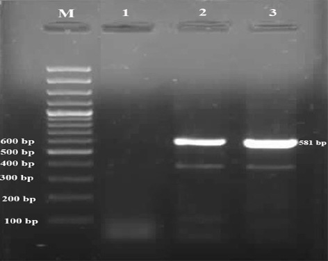 Figure 1: