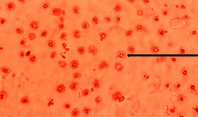 Figure 2: