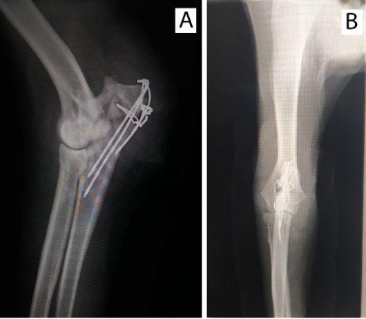 Figure 3: