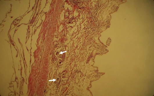 Figure 3: