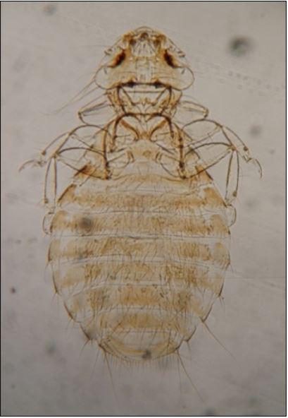Figure 2: