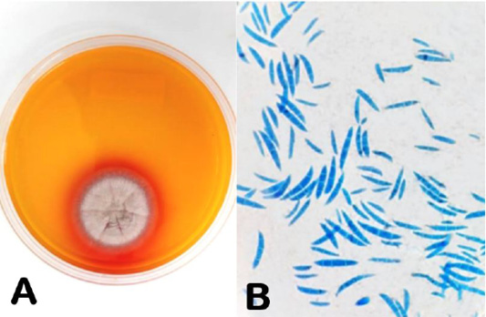 Figure 2: