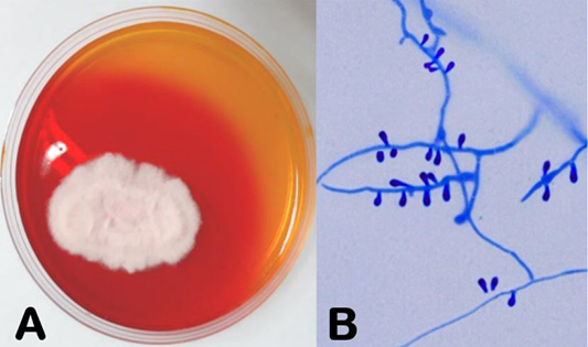 Figure 3: