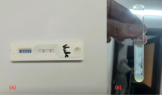 Figure 2: