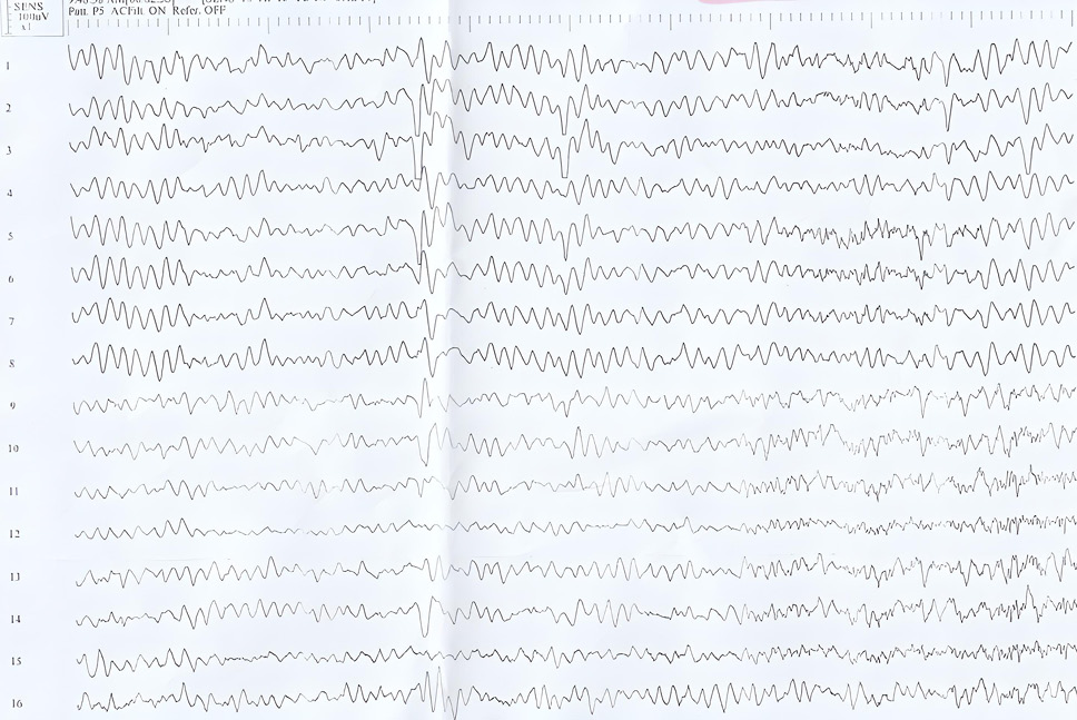 Fig. 2.