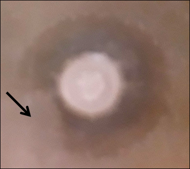 Fig. 6.