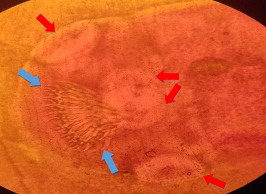 Figure 2: