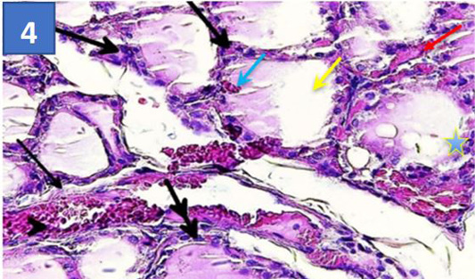 Figure 4: