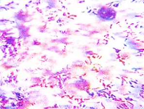 Figure 2: