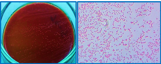 Figure 4: