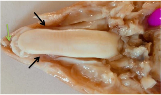 Figure 2: