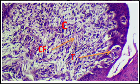 Figure 14: