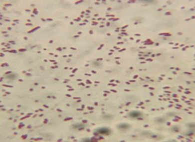 Figure 2: