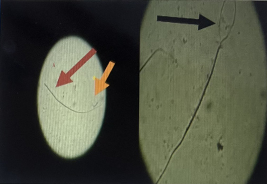 Figure 2: