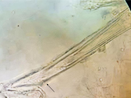 Figure 4: