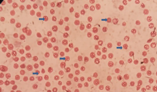 Fig. 2.
