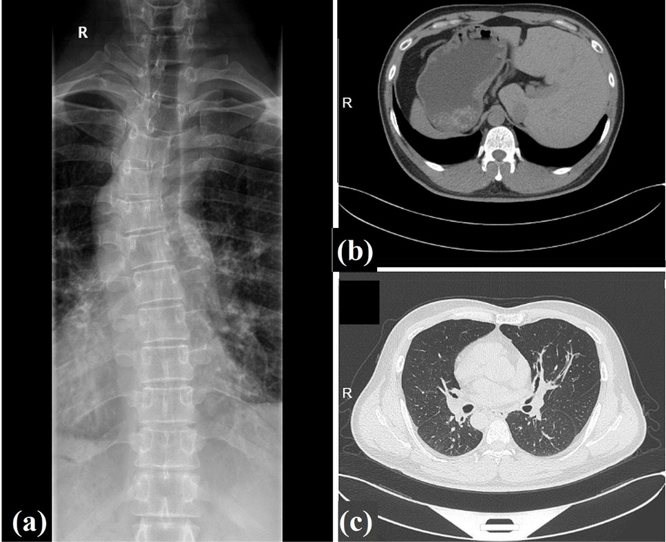 Fig. 3.