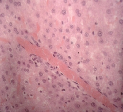 Figure 11: