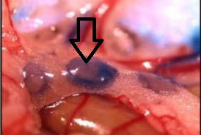 Figure 2: