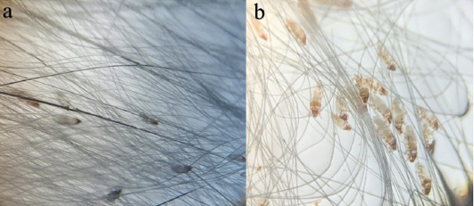Figure 2: